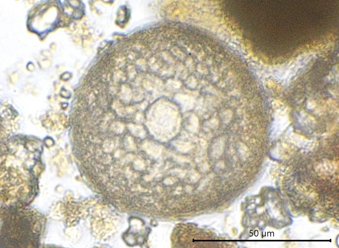 Centropyxis stolata